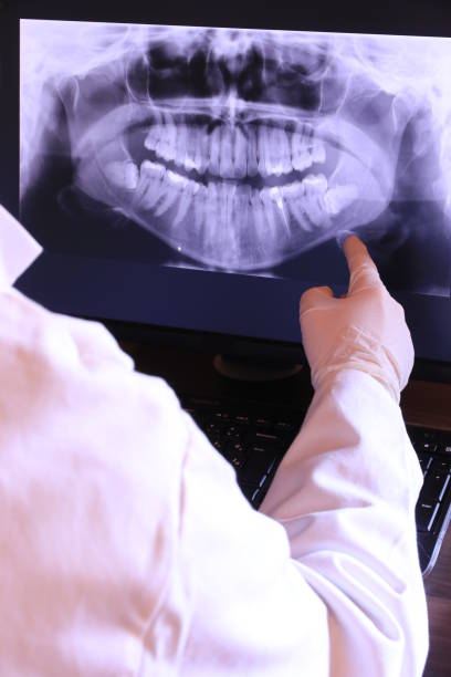 Best Emergency Root Canal Treatment in Frewsburg, NY